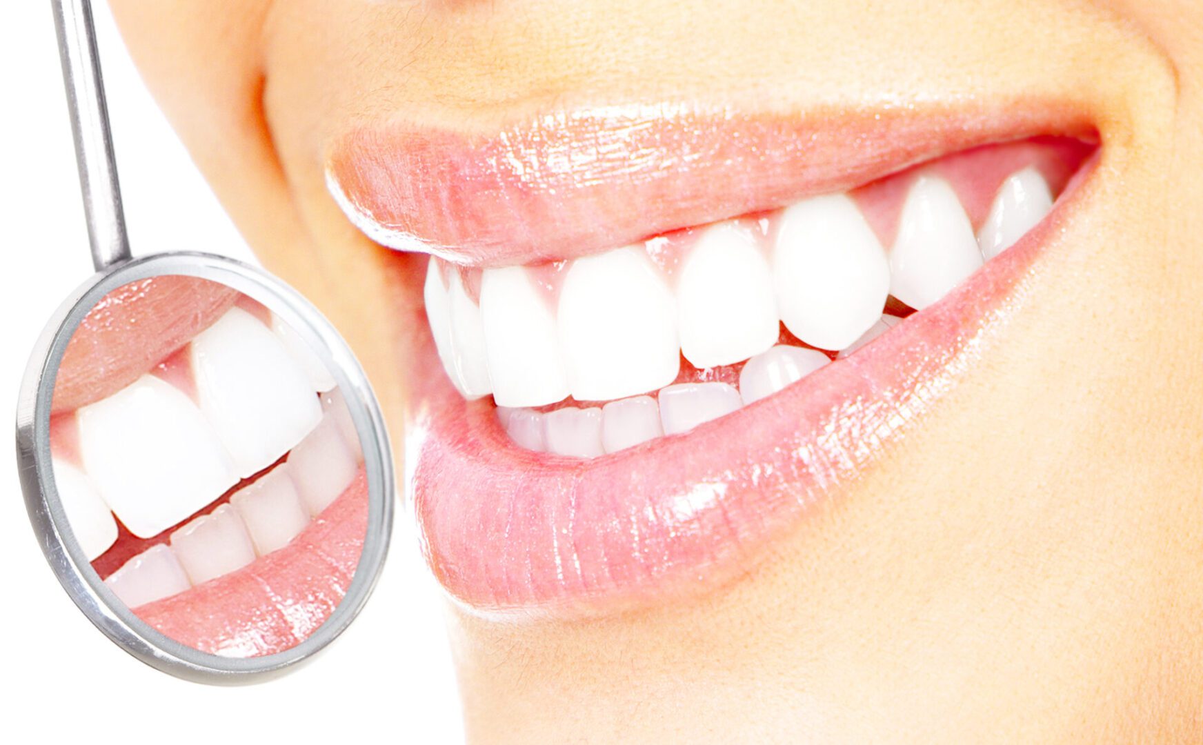 Bright white smile reflected in dental mirror