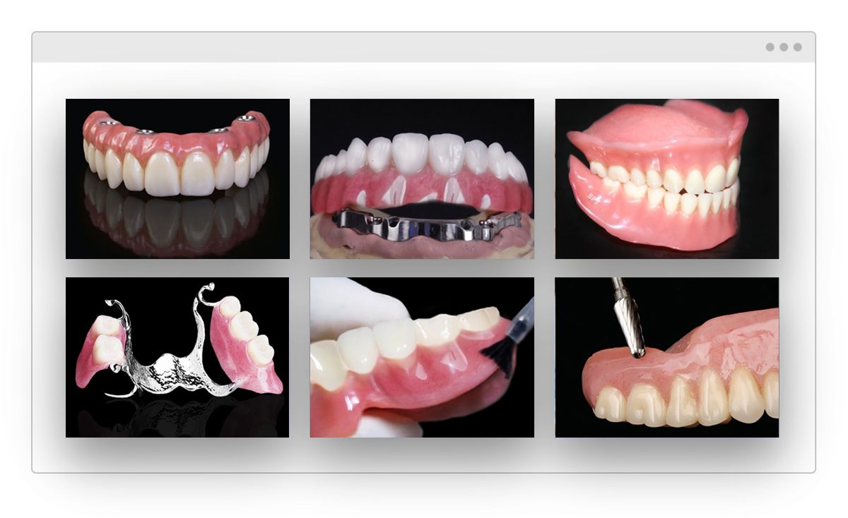 A collage picture of different types of denture services