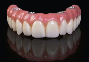 An implant retained denture on a black background.