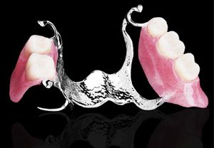 A picture of the partial denture on the black background